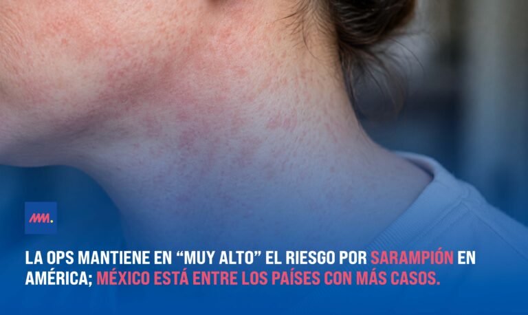 OPS mantiene alerta por sarampión; México registra miles de casos